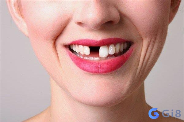 Giấc mơ thấy bị rụng răng rất phổ biến